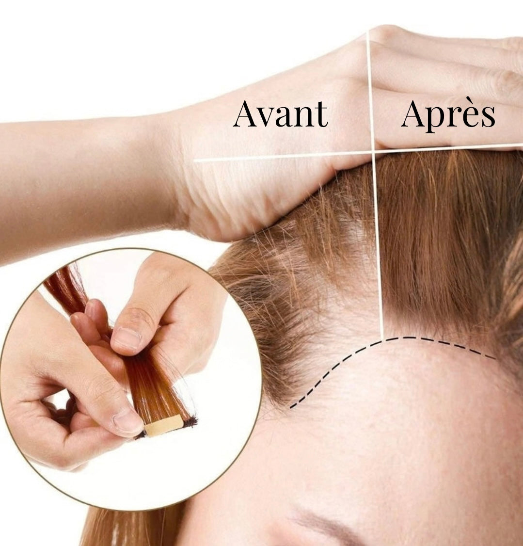 Patchs Invisibles pour Lace — Fixation Discrète